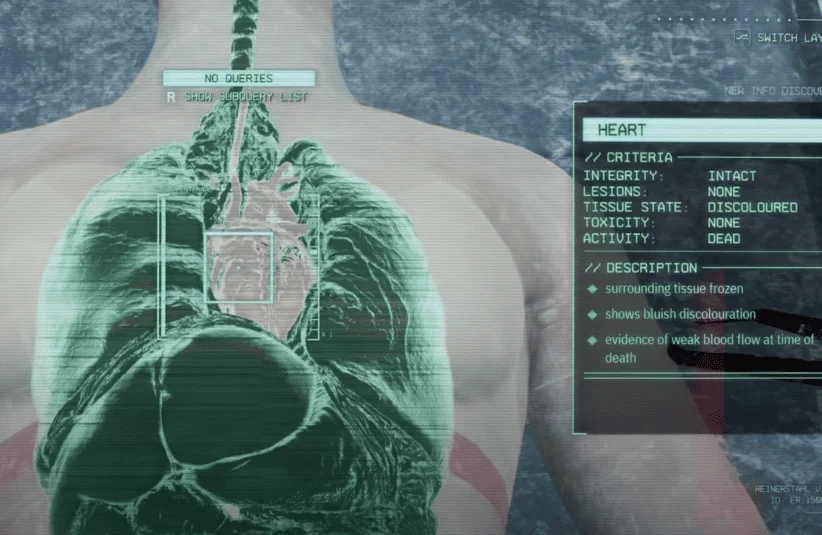 MALPRAXIS, body horror sci-fi sim, medical procedures performed by robot, S.P.I.D.E.R., with Dr. Samuel Edwards, choices influence story, moral dilemma, blood and gore, anatomy, graphic depictions of organs and injuries, Steam, Epic Games, 2026 Game Release, X-Ray of patient