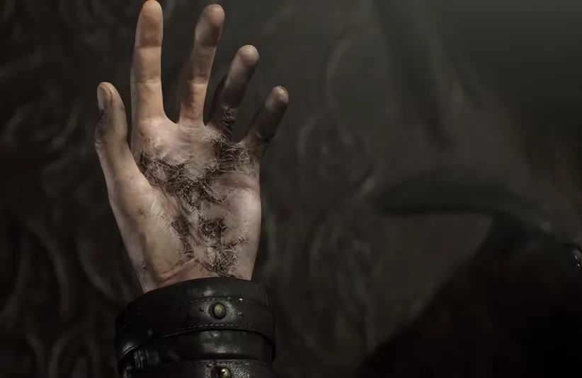 Leon's infection in his hand in Resident Evil Requiem