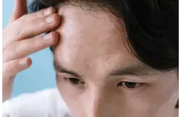 A person placing the hand on the forehead below their brown hair, showing signs of having skin fatigue.