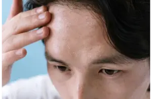 A person placing the hand on the forehead below their brown hair, showing signs of having skin fatigue.